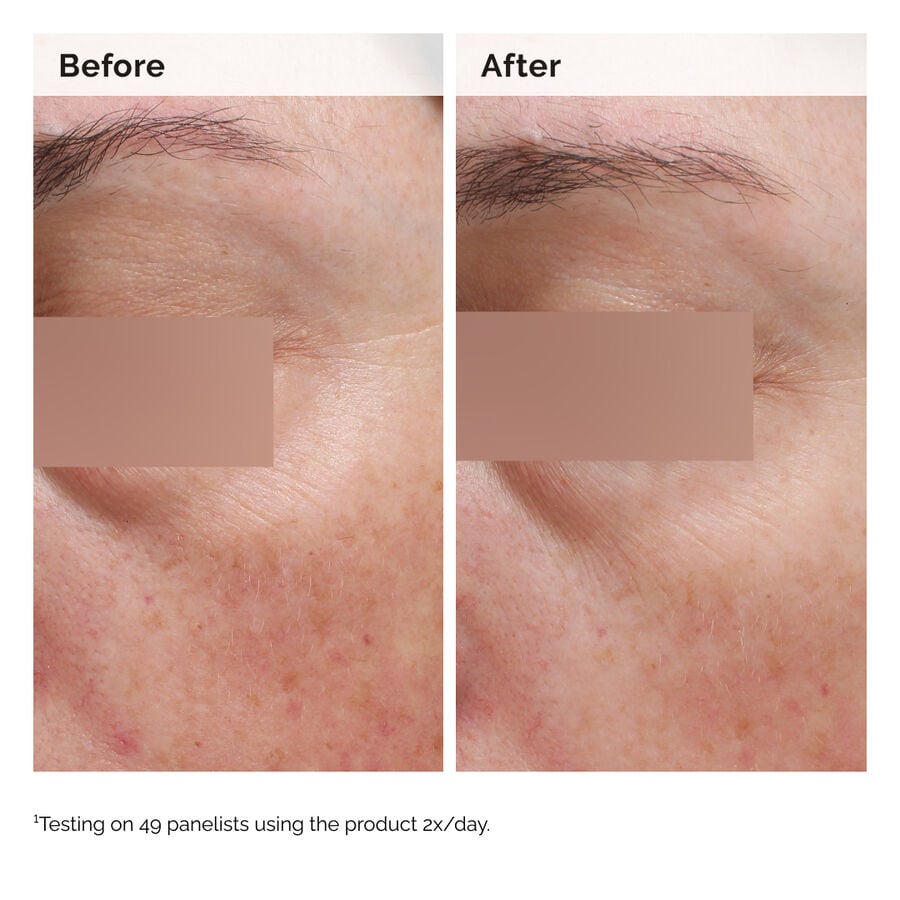 niacinamide-5-face-and-body-emulsion-a3 2024-08-23-ORD-Nia-5pct-Face-Body-B-A-Elasticity-Global-02-1x1.jpg