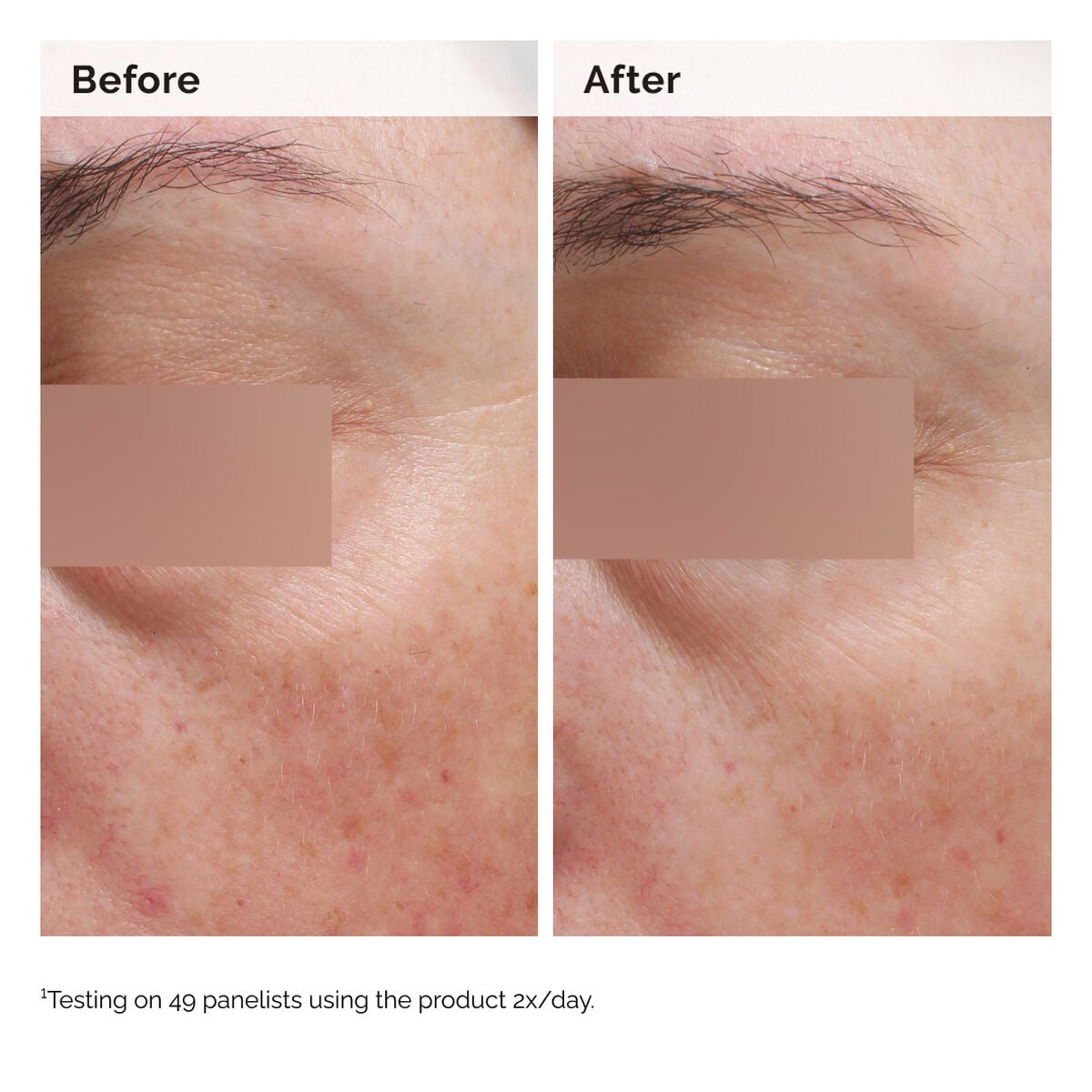 niacinamide-5-face-and-body-emulsion-a3 2024-08-23-ORD-Nia-5pct-Face-Body-B-A-Elasticity-Global-02-1x1.jpg