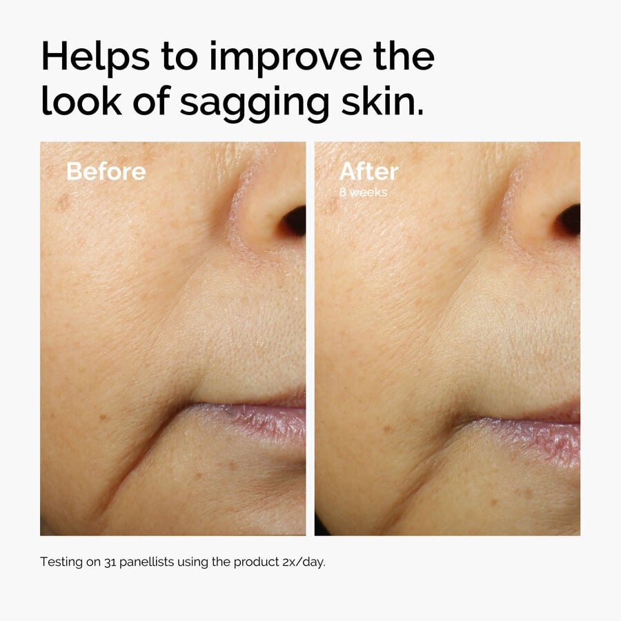 caffeine-3-escin-1-face-serum-w4 ord-caffeine-3pct-escin-1pct-face-serum-before-after-sagging.jpg