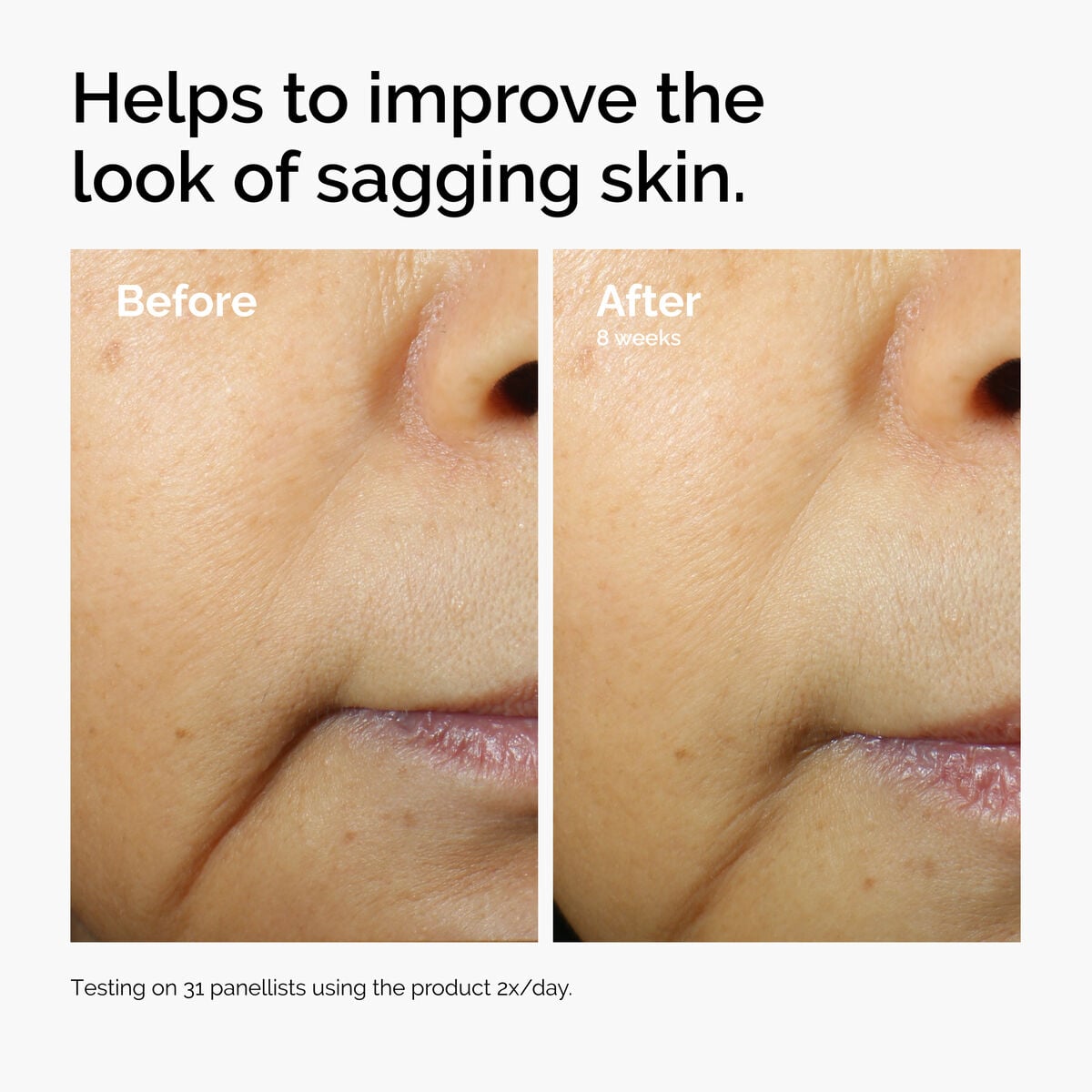 caffeine-3-escin-1-face-serum-w4 ord-caffeine-3pct-escin-1pct-face-serum-before-after-sagging.jpg