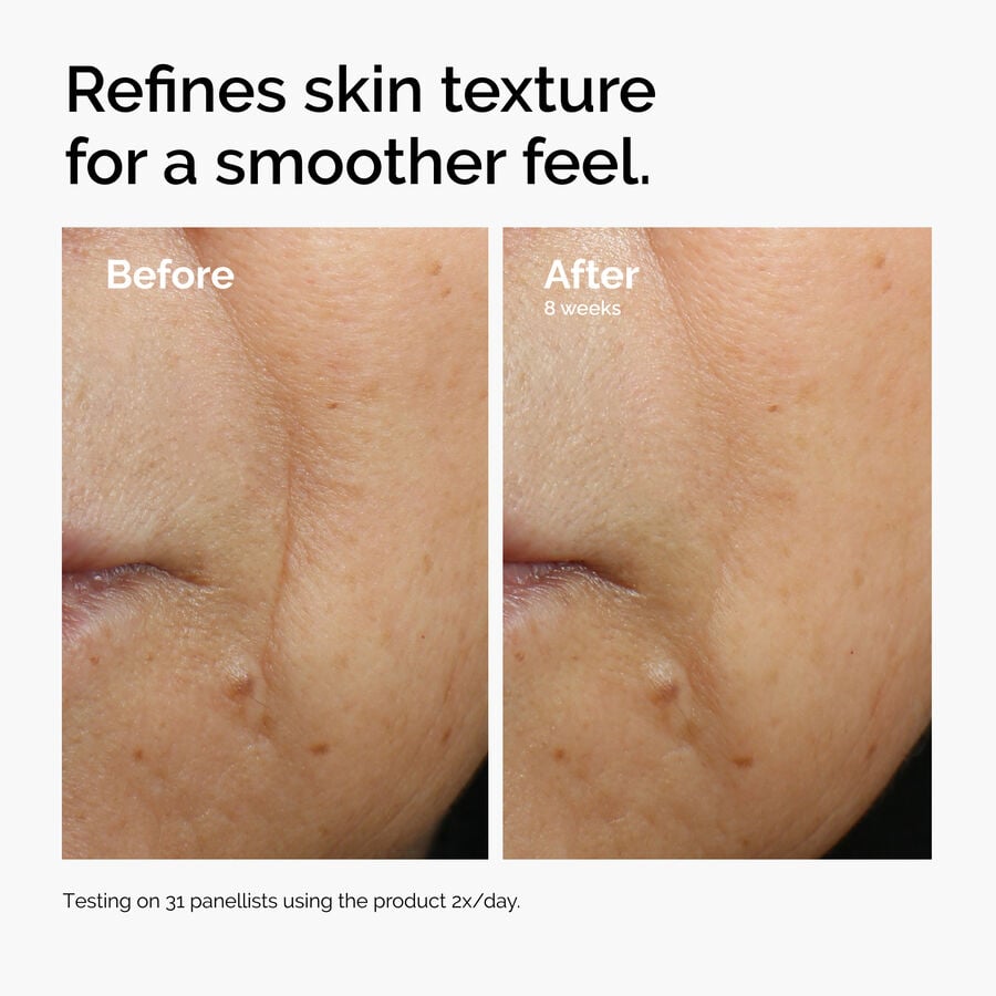 caffeine-3-escin-1-face-serum-w4 ord-caffeine-3pct-escin-1pct-face-serum-before-after-texture.jpg