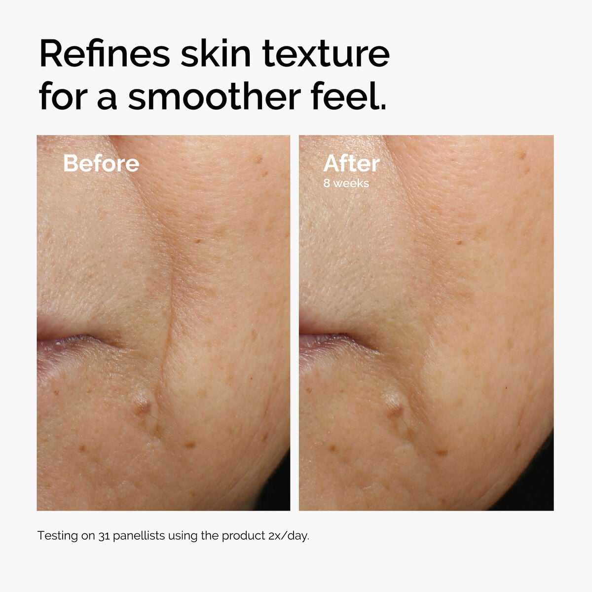 caffeine-3-escin-1-face-serum-w4 ord-caffeine-3pct-escin-1pct-face-serum-before-after-texture.jpg