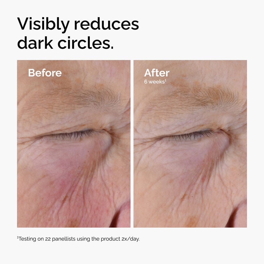 caffeine-solution-5-egcg-eye-serum-j1 ord-caffeine-solution-egcg-dark-circles-before-after.jpg