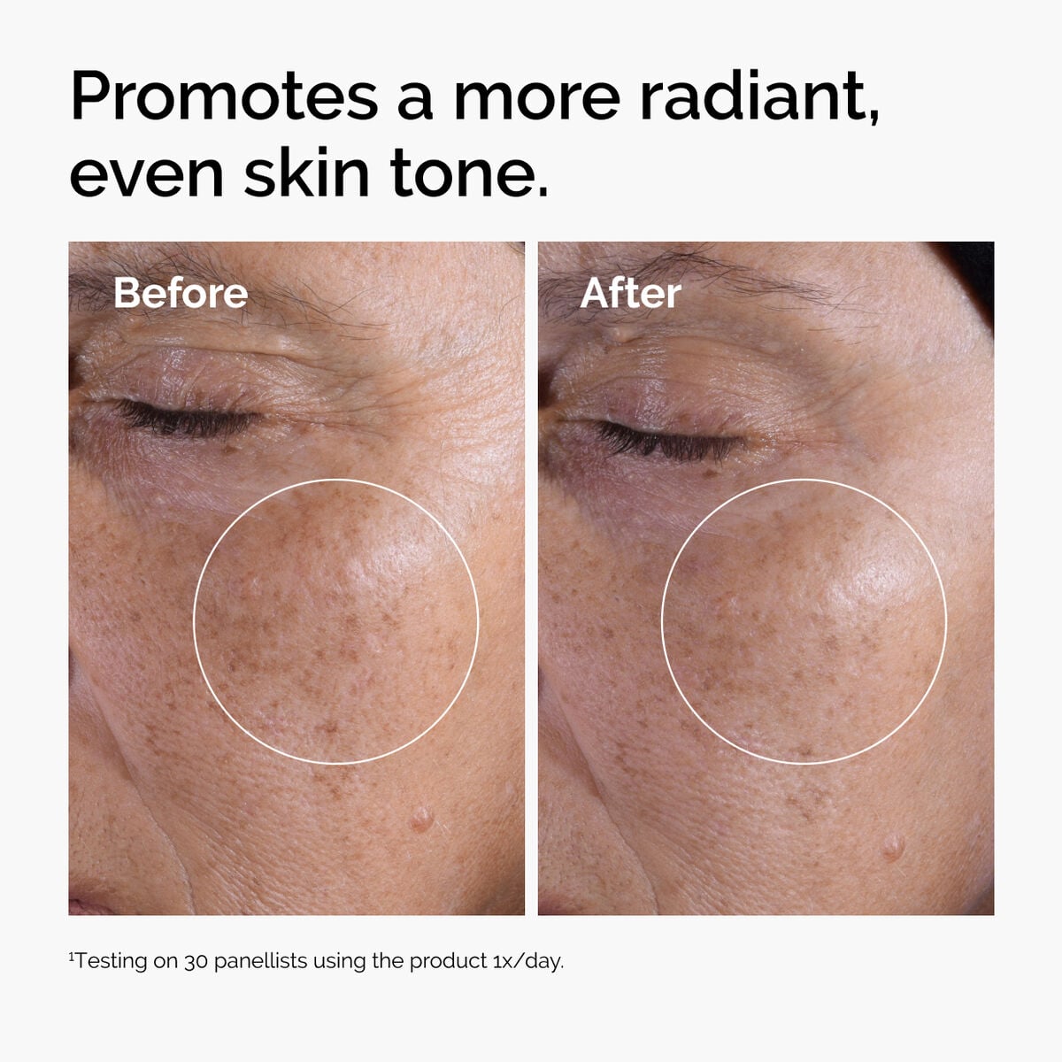 glycolic-acid-7-exfoliating-toner-a4 ord-glycolic-before-after-radiance.jpg