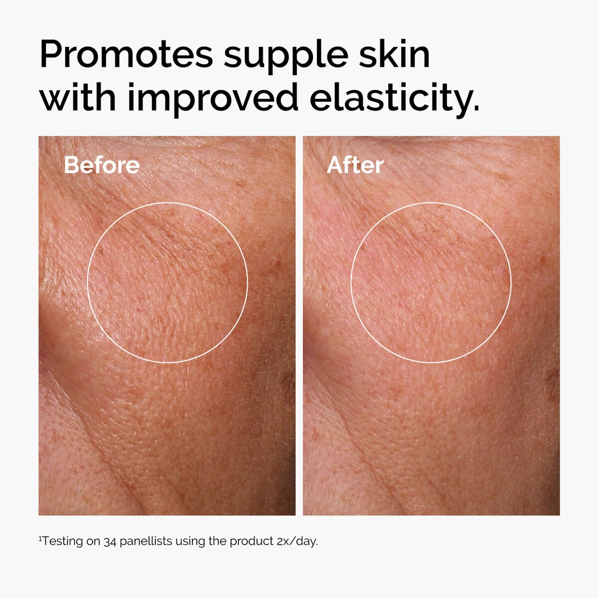 hyaluronic-acid-2-b5-with-ceramides-j7 ord-hyaluronic-acid-2pct-b5-hydrating-serum-before-after-elasticity.jpg