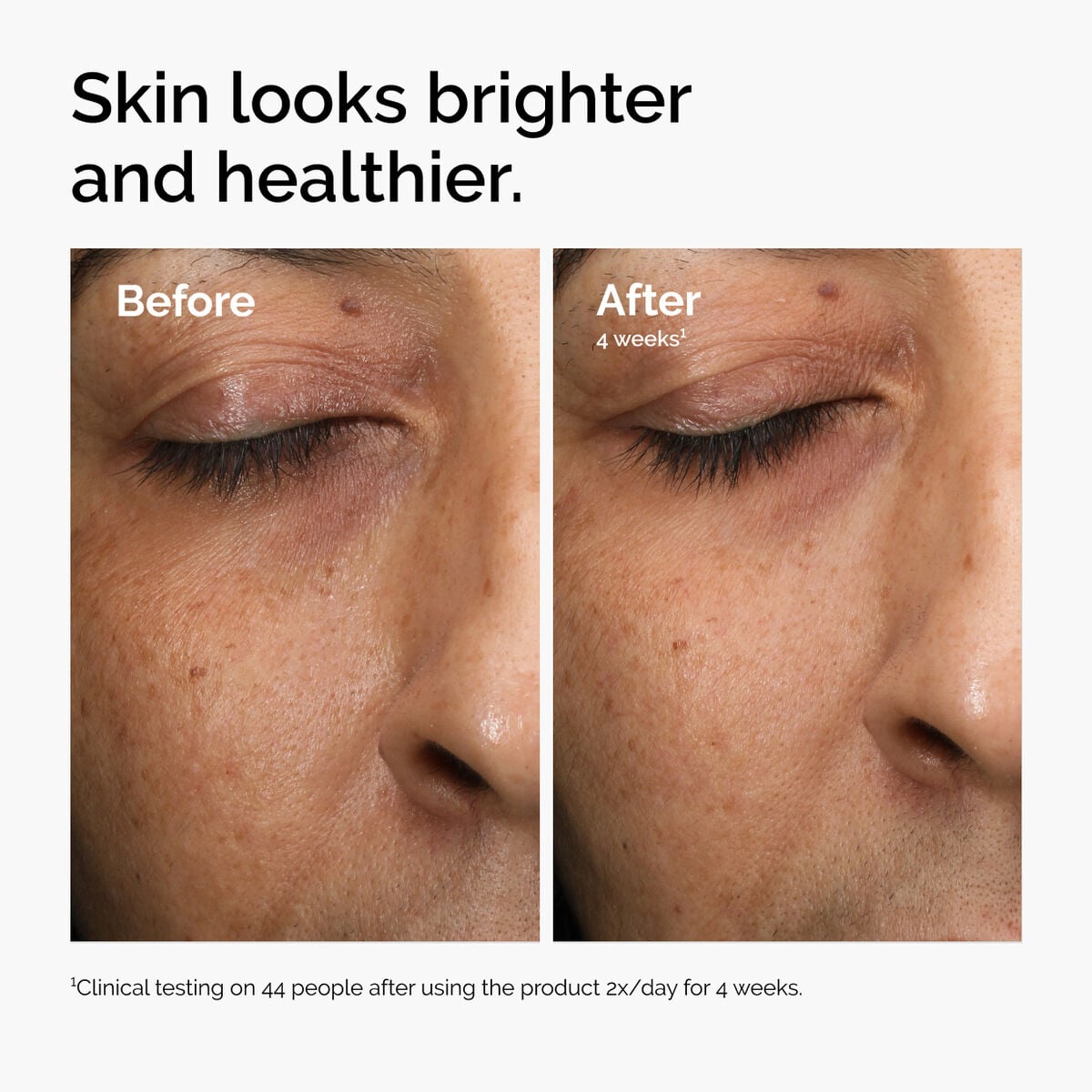 multi-antioxidant-radiance-serum-i3 ord-mars-before-after-healthy.jpg