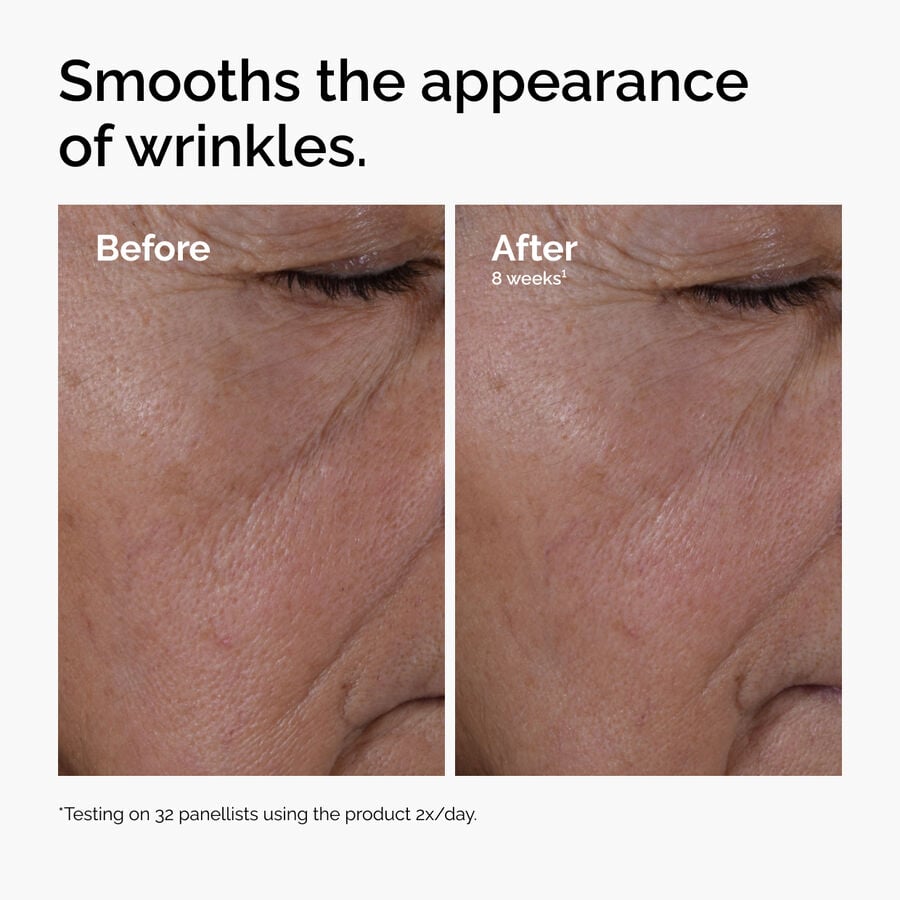 multi-peptide-ha-serum-i8 ord-multi-peptide-ha-serum-wrinkles-before-after.jpg