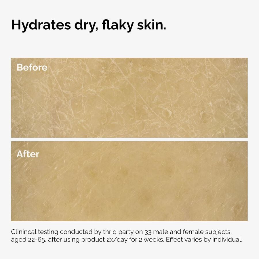 the-body-care-collection-n2 ord-natural-moisturizing-factors-inulin-body-before-after-graphic-02.jpg