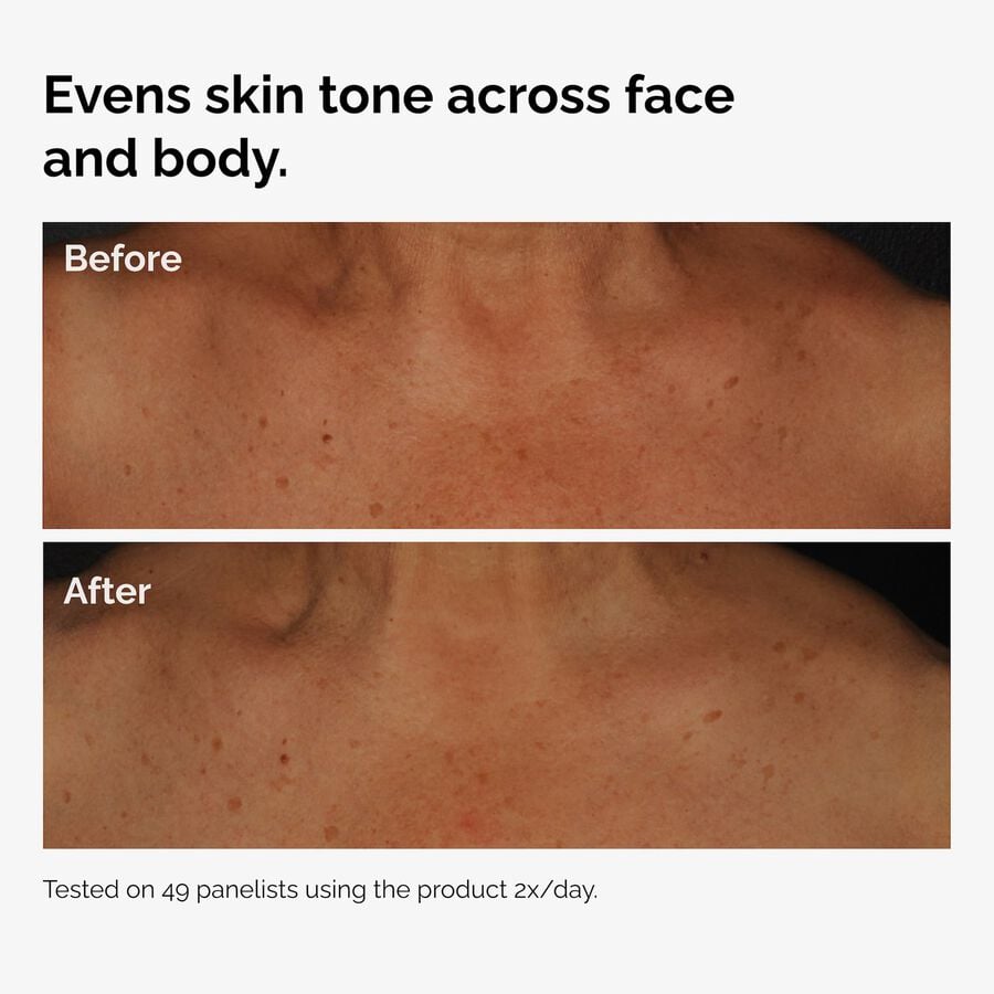 the-body-care-collection-n2 ord-niacinamide-face-body-serum-before-after-even-tone-graphic.jpg