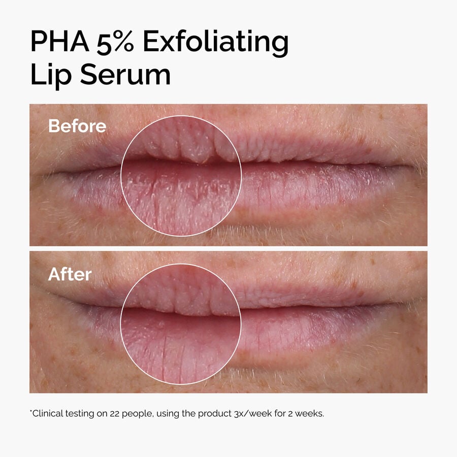 pha-5-exfoliating-lip-serum-a8 ord-pha-5pct-lip-exfoliating-serum-before-after.jpg