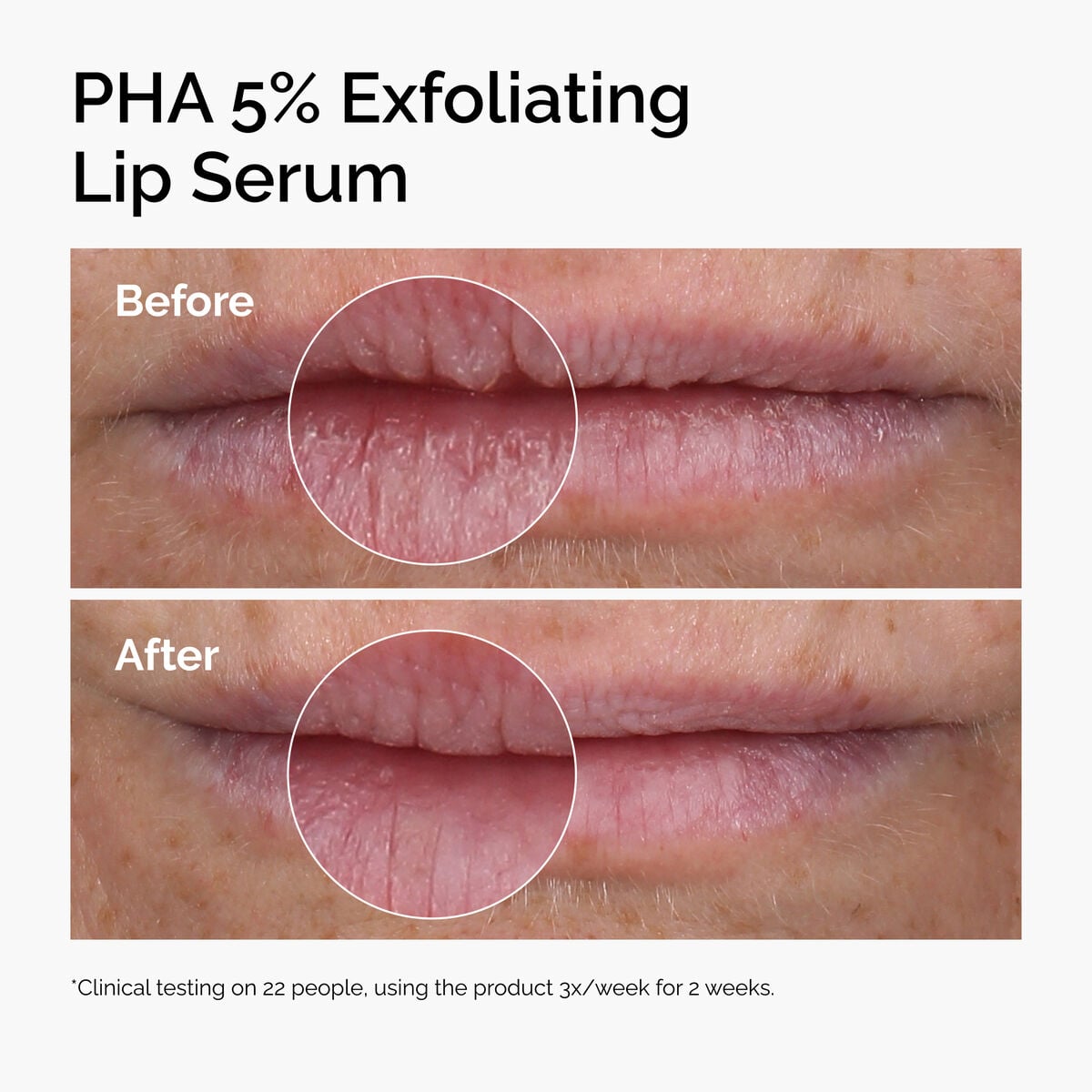 pha-5-exfoliating-lip-serum-a8 ord-pha-5pct-lip-exfoliating-serum-before-after.jpg