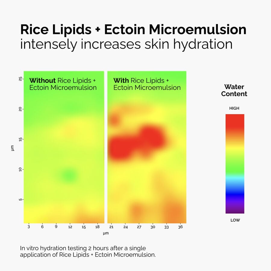 rice-lipids-ectoin-microemulsion-r6 ord-rice-lipids-ectoin-microemulsion-thermal-before-after.jpg